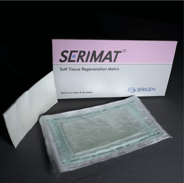 Serimat Soft Tissue Regeneration Matrix with Silk Protein