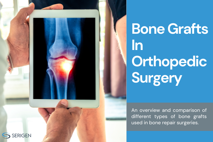 Bone grafts in orthopedic surgery - an overview