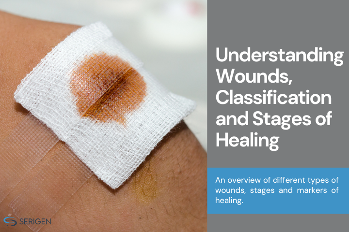 Understanding Wounds: Classification and Stages of Healing - Serigen ...