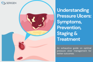 pressure ulcer management