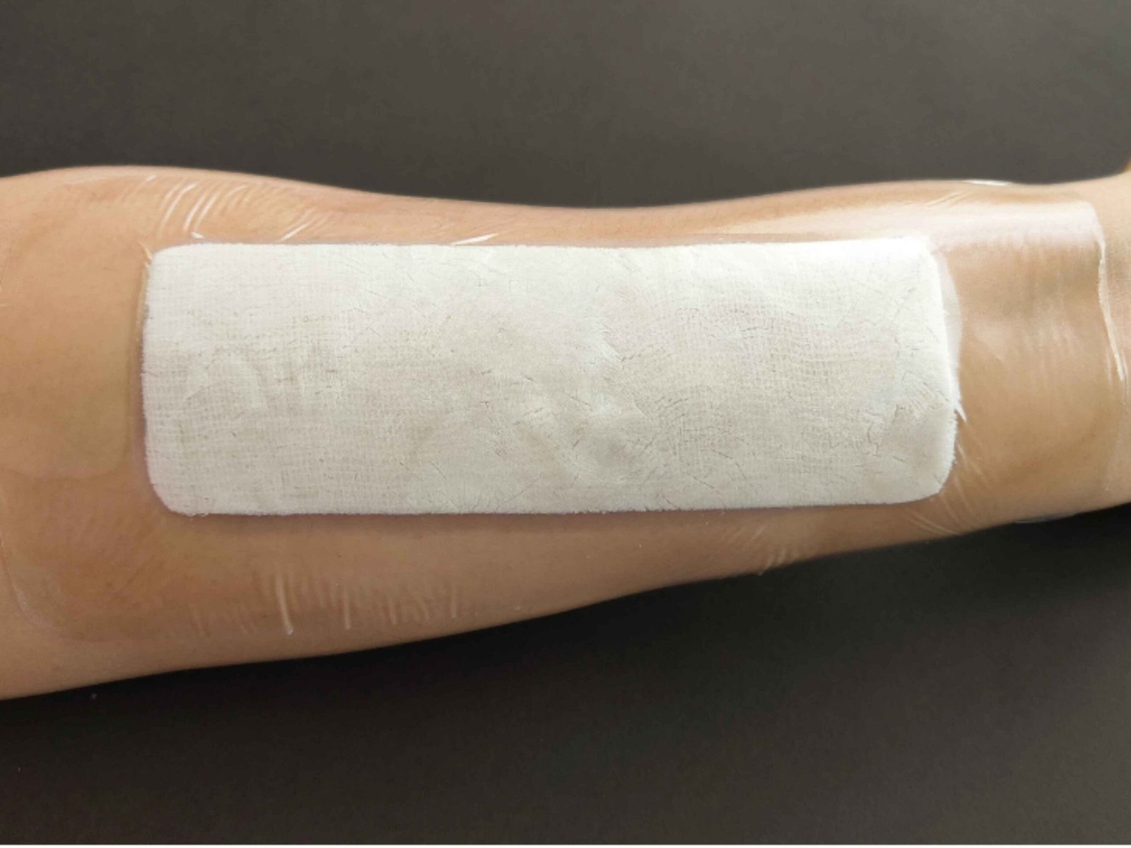 post-op horizontal (1)