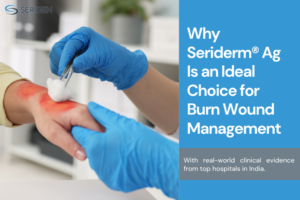 best wound dressing for burns