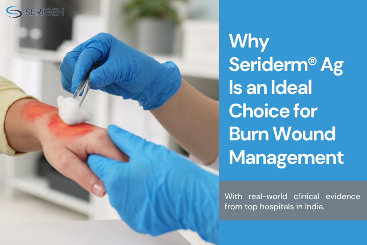 best wound dressing for burns